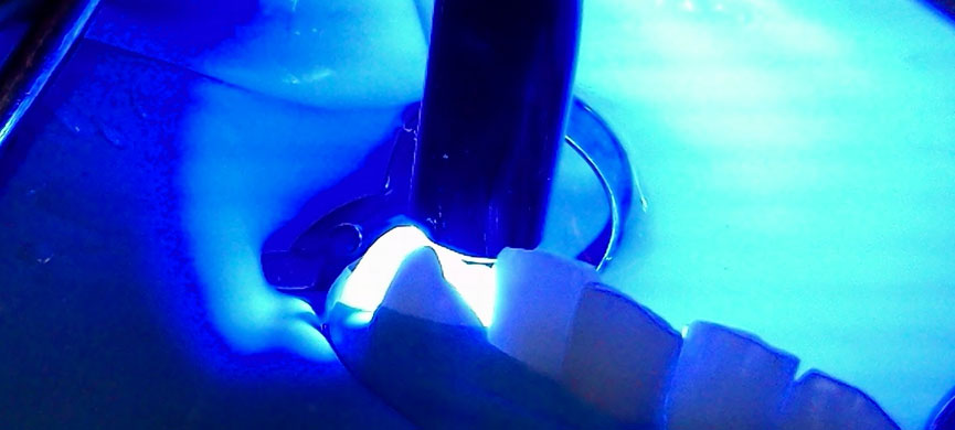 La luz ultravioleta mejora los implantes dentales